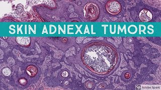 Skin Adnexal Tumors: Dermatopathology Unknown Cases