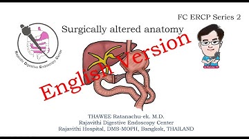 FC ERCP Series 2 Surgically altered anatomy English version