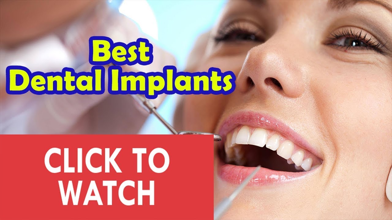 Dental Implants Kenosha, WI Dental Implant And Dentistry Procedure
