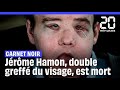 Mort de jrme hamon lhomme aux deux greffes de visage