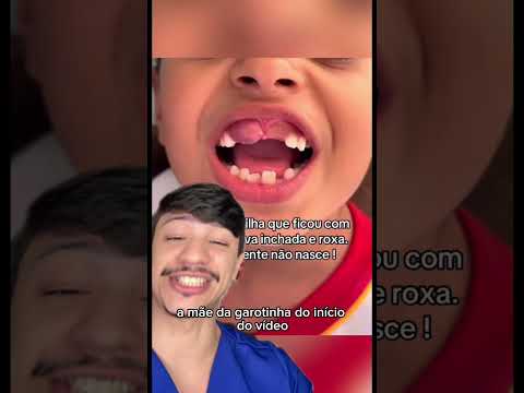 Sua Criança vai chegar com a boca assim...Você deve saber o que fazer #shorts