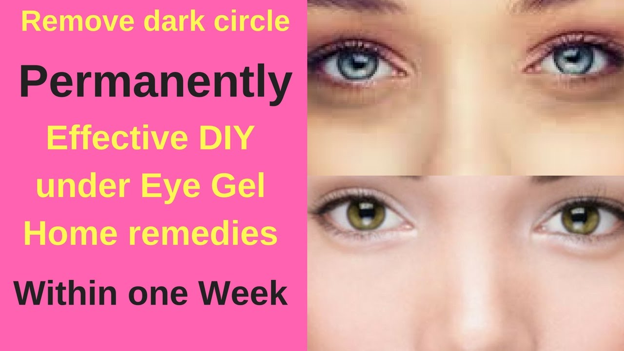 How To Get Rid Of Dark Circles Permanently Home Remedies