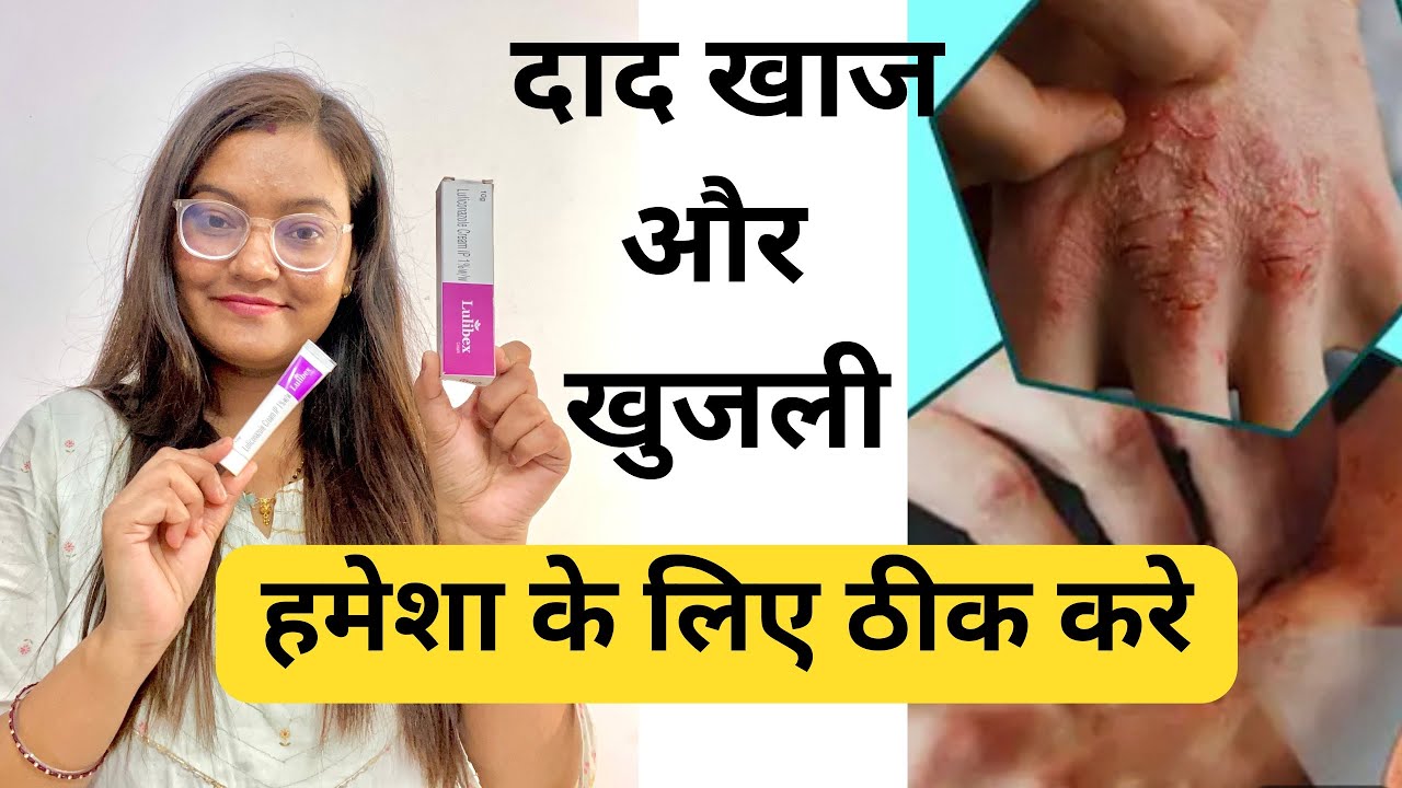 दाद खाज और खुजली को हमेशा के लिए ठीक करने वाली क्रीम | lulibex cream