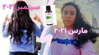 تجربتي لزيت الروزماري لتطويل تكثيف الشعر Rosemary Oil for Hair #shorts