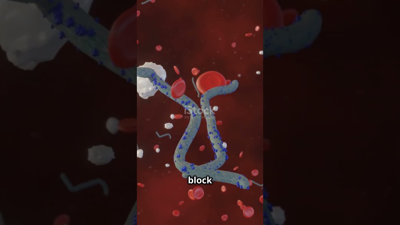 Filariasis: The Parasite That Swells You Up