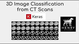 3D Image Classification from CT Scans - Keras Code Examples screenshot 3