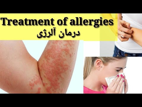 درمان آلرژی و کهیر پوستی treatment of allergies