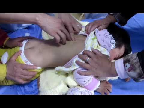 acupuncture-for-cerebral-palsy-dr-shashikant-www-imwellyoga-com-im-well-pvt-ltd