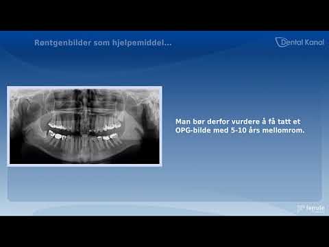 Video: Kombinert Immunsvikt (CID) Hos Hester