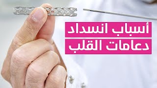 Stent 🧡 أسباب انسداد دعامات القلب