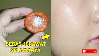 Tips Merawat Kulit Berminyak (Oily Skin). Bebas Jerawat!