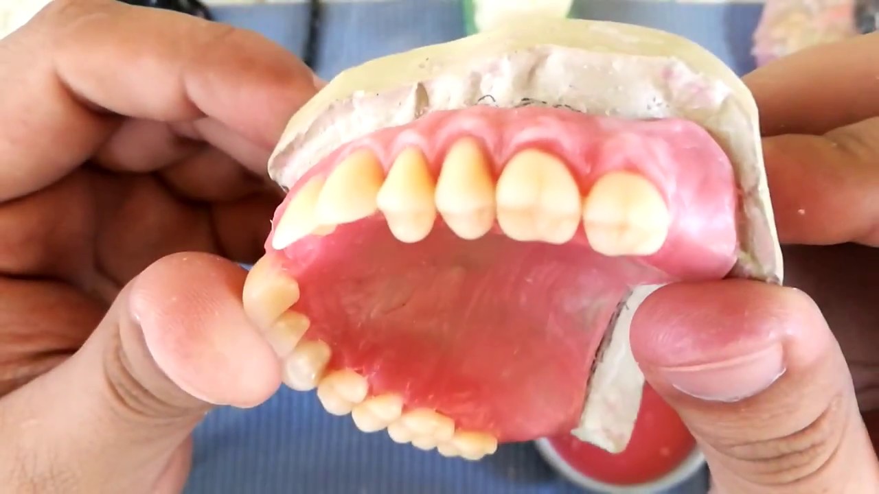 Caracterizado Gingival (Wax) 1ra Fase