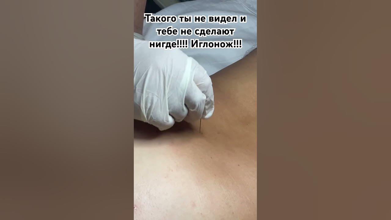 Иглонож. Китайская традиционная медицина. Остров, Хайнань, Китай. # ...