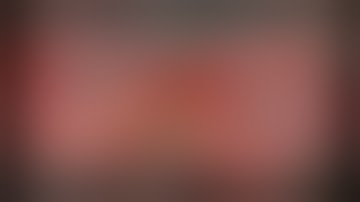 CataractCoach 1661 X-NIT technique simplifies Yamane IOL fixation