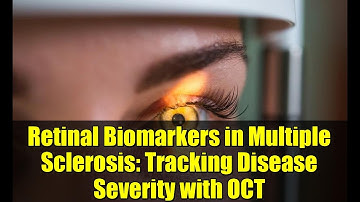 Retinal Biomarkers in Multiple Sclerosis: Tracking Disease Severity with OCT