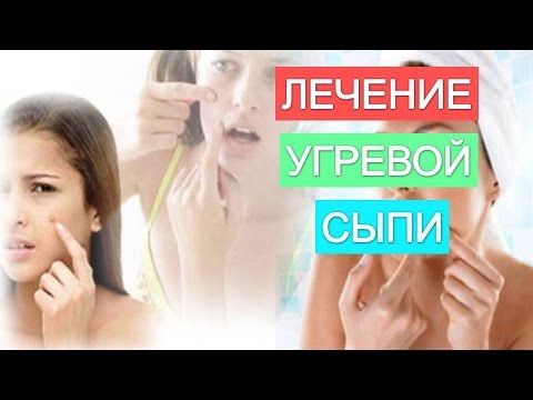 угревая сыпь фото