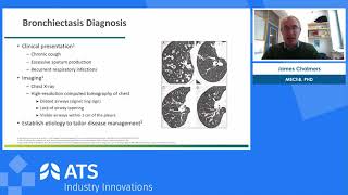 A Deep Dive into the “I”s of Noncystic fibrosis bronchiectasis