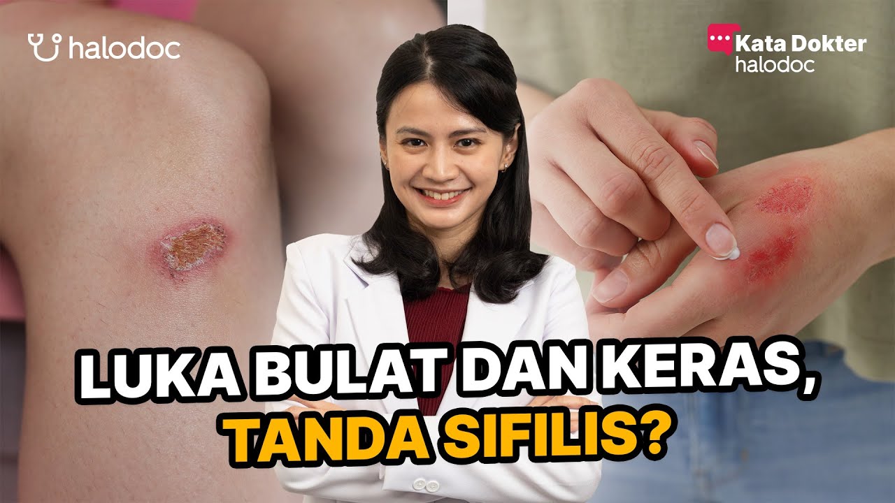 Luka Bulat dan Mengeras: Gejala Sifilis?