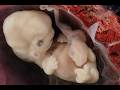 4.6 You Were Once Sexless—Here’s When It Changed | human embryo sex development | key genes