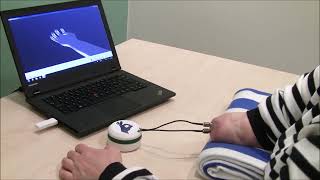 Osseo neuromuscular interface for below elbow amputations (e-OPRA)