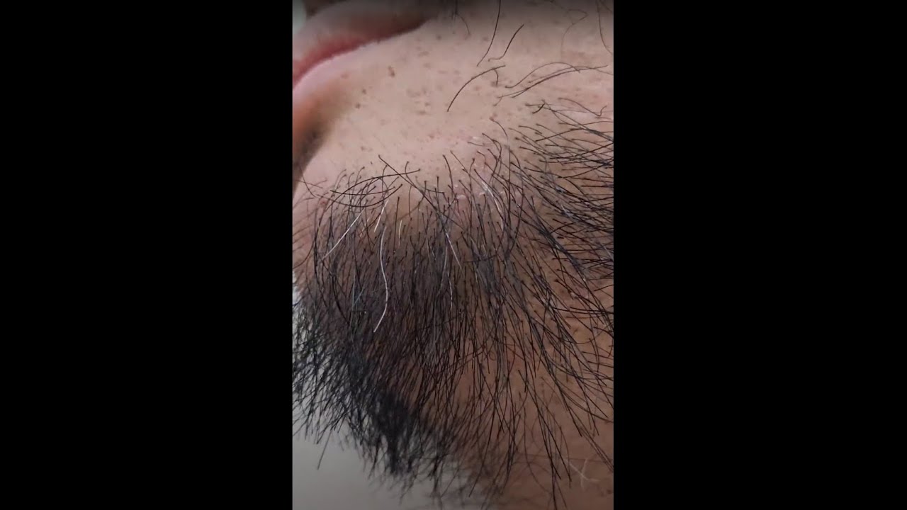 facial-grey-hair-plucking-3-youtube
