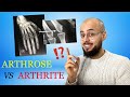Arthrose et arthrite : les différences (causes, symptômes, traitements)