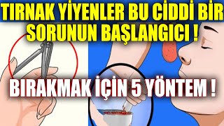 Tırnak Yiyenler Bu Ciddi Bir Sorunun Başlangıcı ! BIRAKMAK İÇİN 5 YÖNTEM !