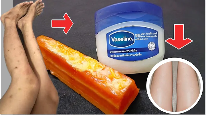 IN 1 DAYS,HOW MY LEG SCARS LIGHTEN FAST USING REMEDIES WITH PAPAYA ,SCAR,MOSQUITO, BITES ON LEGS