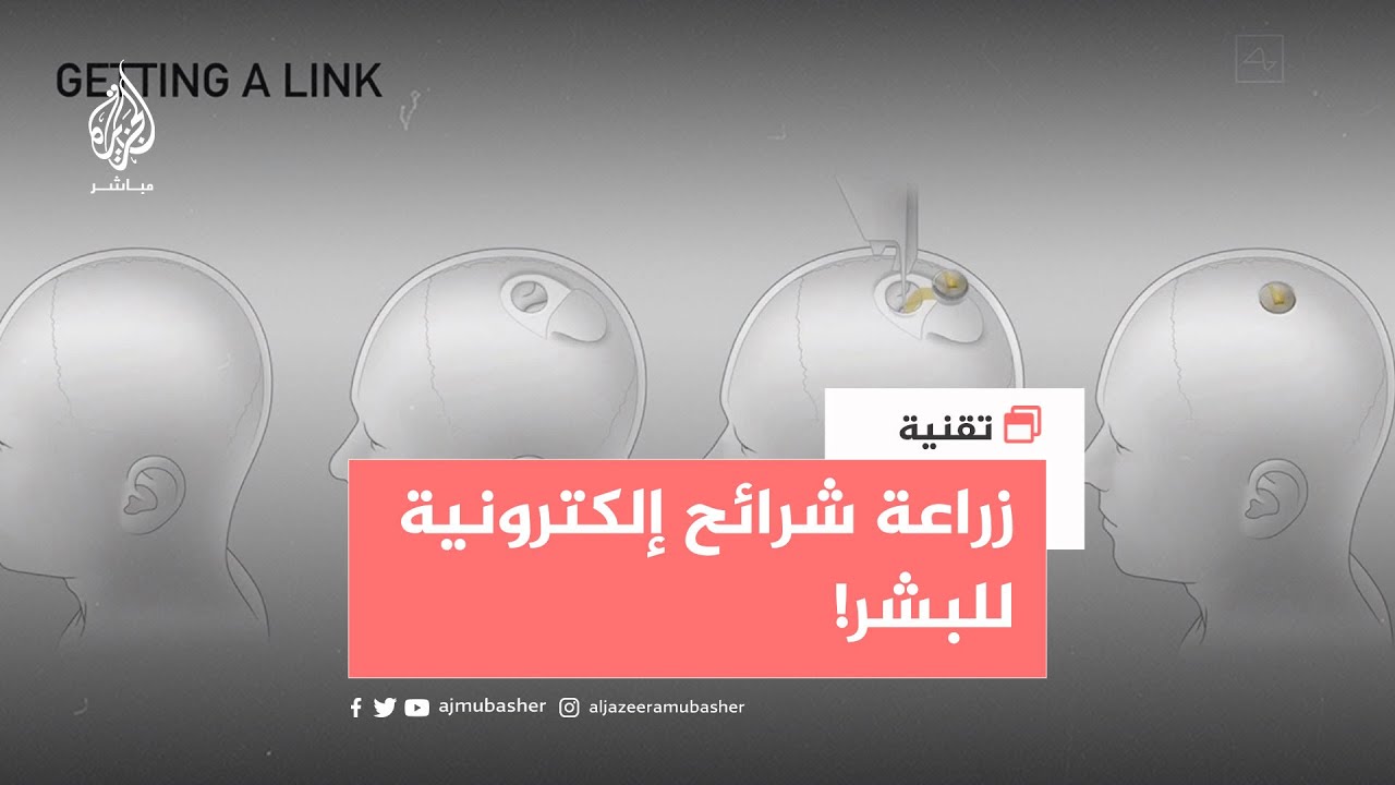 هل توافق على زرع شريحة في دماغك؟
