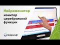 Нейромонитор – монитор церебральной функции с touchscreen-дисплеем на мобильной тележке