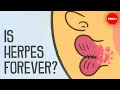 What causes herpes, and how can you treat it? - Christine Johnston thumbnail