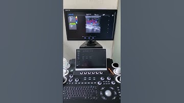 High-end Cart-based Cardiac Color Ultrasound Machine DW T8 #ultrasoundmachine #medicalultrasound