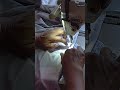 how to attached garter#beddings#shortsvideo