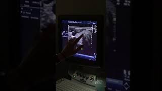 Thyroid Protocol