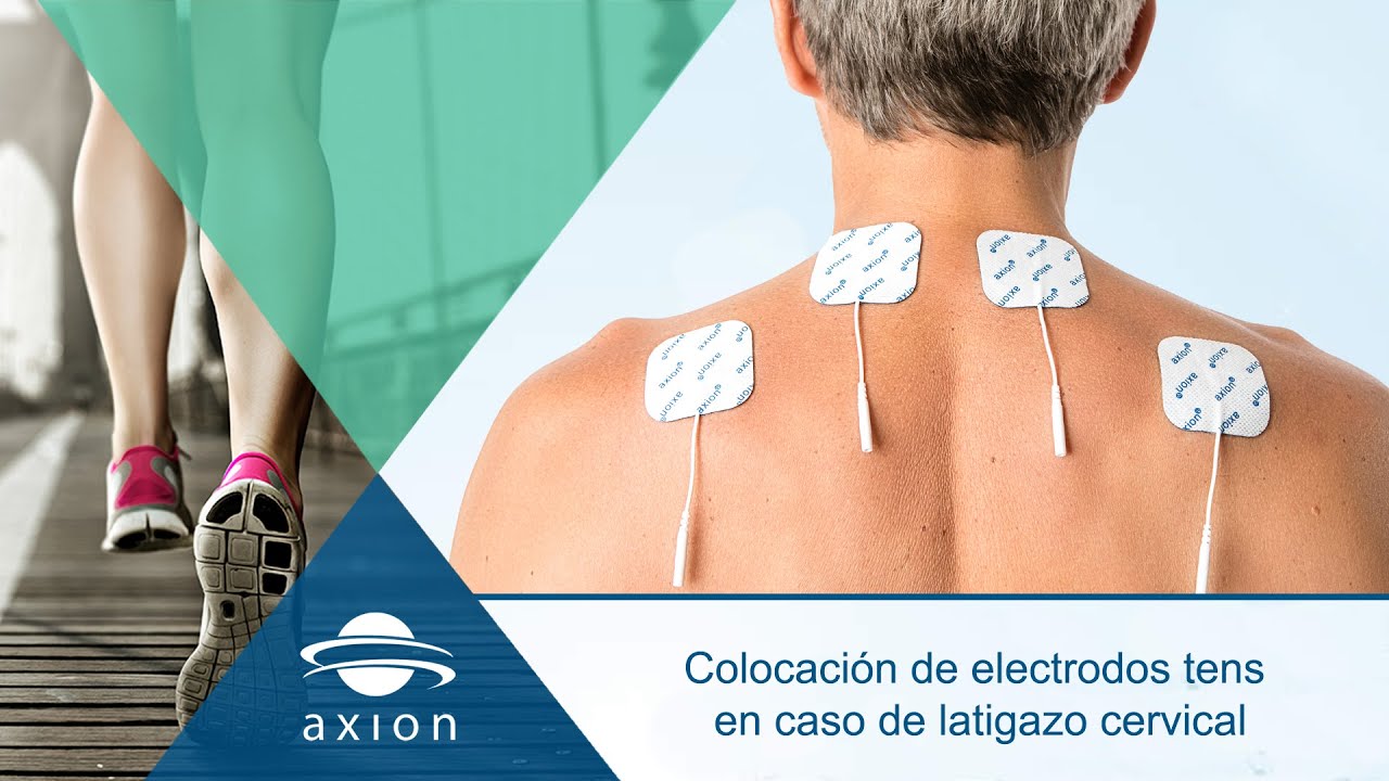 Colocación electrodos TENS para latigazo cervical | Electroestimulación TENS para terapia del dolor