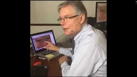 LIVE Recording from Spear Facially Generated Treatment Planning Workshop