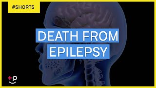 Can You Die From Epilepsy?  #Shorts