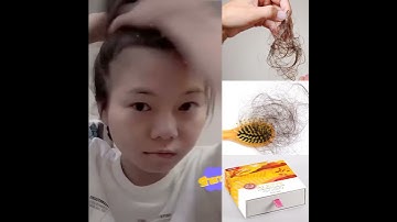 Kết Quả Sau Khi Dùng| Alette - Túi Lọc Gội Đầu Detox |Trị Rụng Tóc - Giúp Mọc Tóc Nhanh - Dày - Khỏe