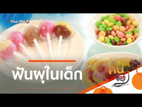 ฟันผุในเด็ก : รู้สู้โรค (10 มิ.ย. 63)