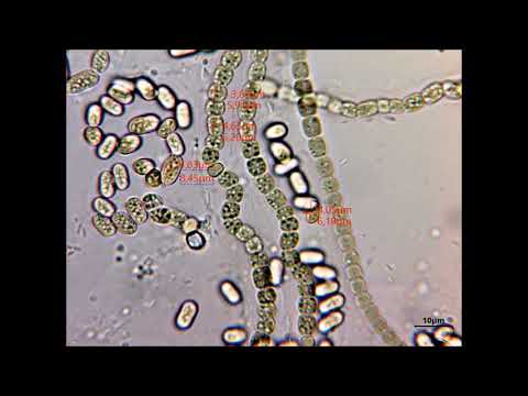 Цианобактерии (сине-зеленые водоросли).  Вид в микроскоп.