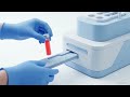 2025 ESC/EAS Dyslipidemia Guidelines: What Changed and Why It Matters @sinaRaafat 