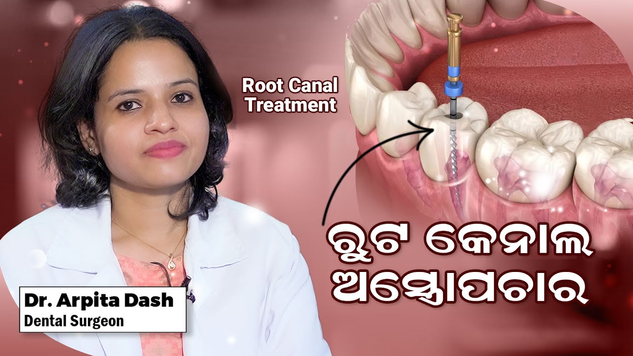 Root Canal Treatment: Everything You Need To Know | Dr. Arpita Dash | Swasthya Sambad