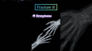 fracture treatment and first aid 🛡️⛑️😔#first aid