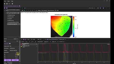 Data Analysis using BV Workbench - 4-1. Activation map