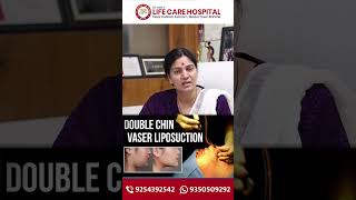 Double Chin Removal Without Surgery | HIFU Treatment for Jawline Contouring