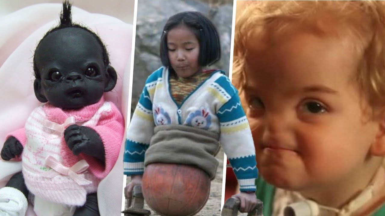 10 Increíbles NIÑOS Que Son ÚNICOS En El Mundo *NO CREERAS Que EXISTEN ...