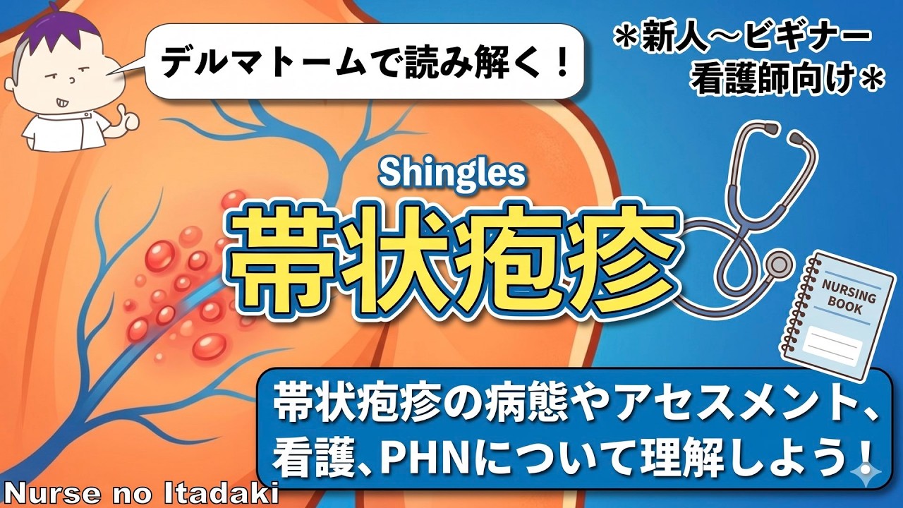 【帯状疱疹の極意!】病態やデルマトーム、PHN予防など、看護師が理解しておきたい知識を伝授!