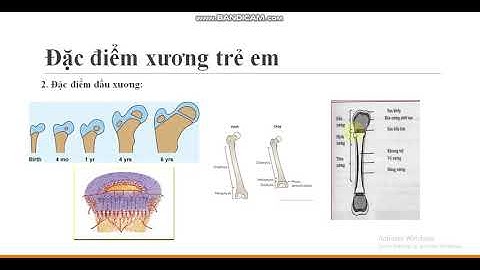 So sánh xương trẻ em và xương người lớn năm 2024