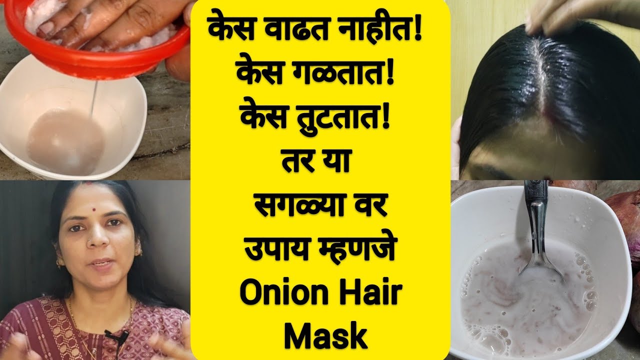 केस वाढत नाहीत! केस गळतात! केस तुटतात! तर या सगळ्या वरउपाय म्हणजे Onion