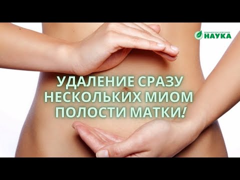 Video: Миома жана кош бойлуулук: Кыскача психологиялык тукумсуздук жөнүндө